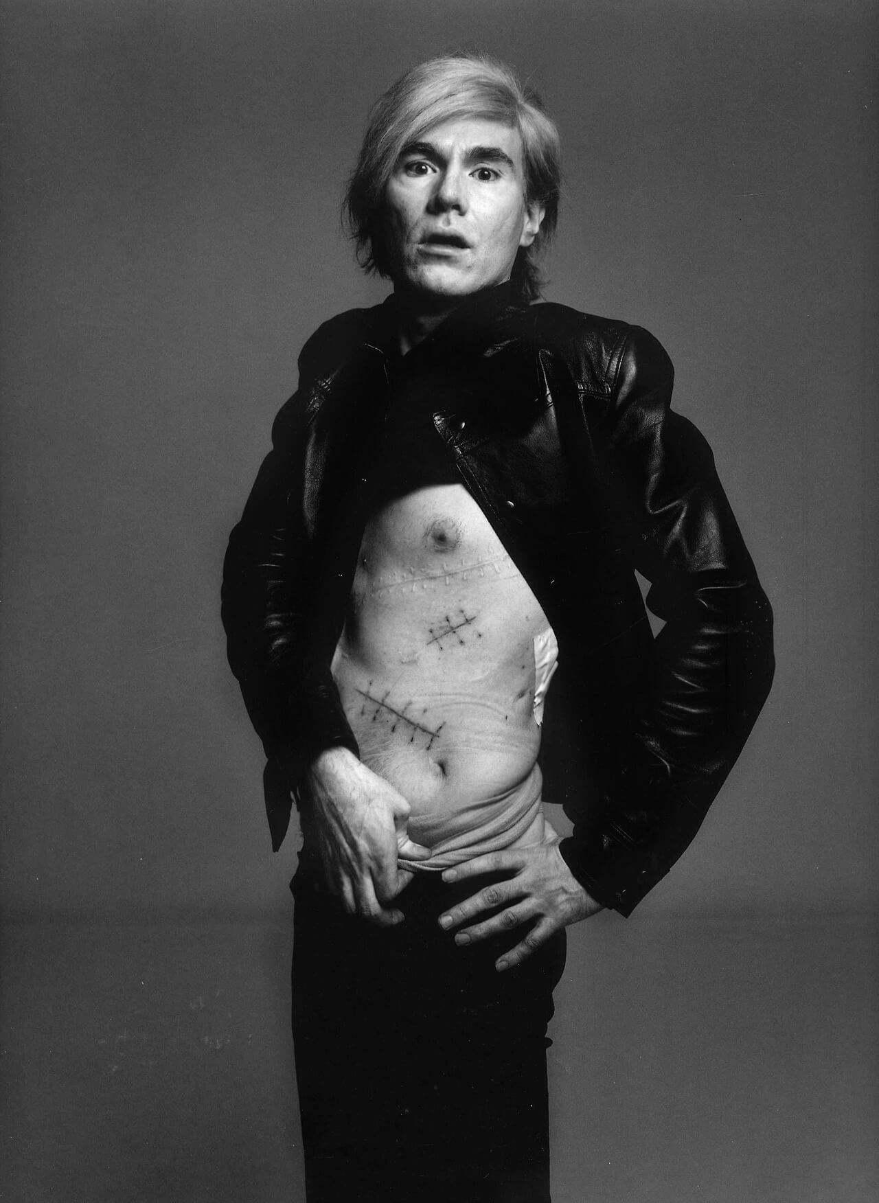 Richard Avedon's 1969 portrait of Andy Warhol, revealing his surgical scars.